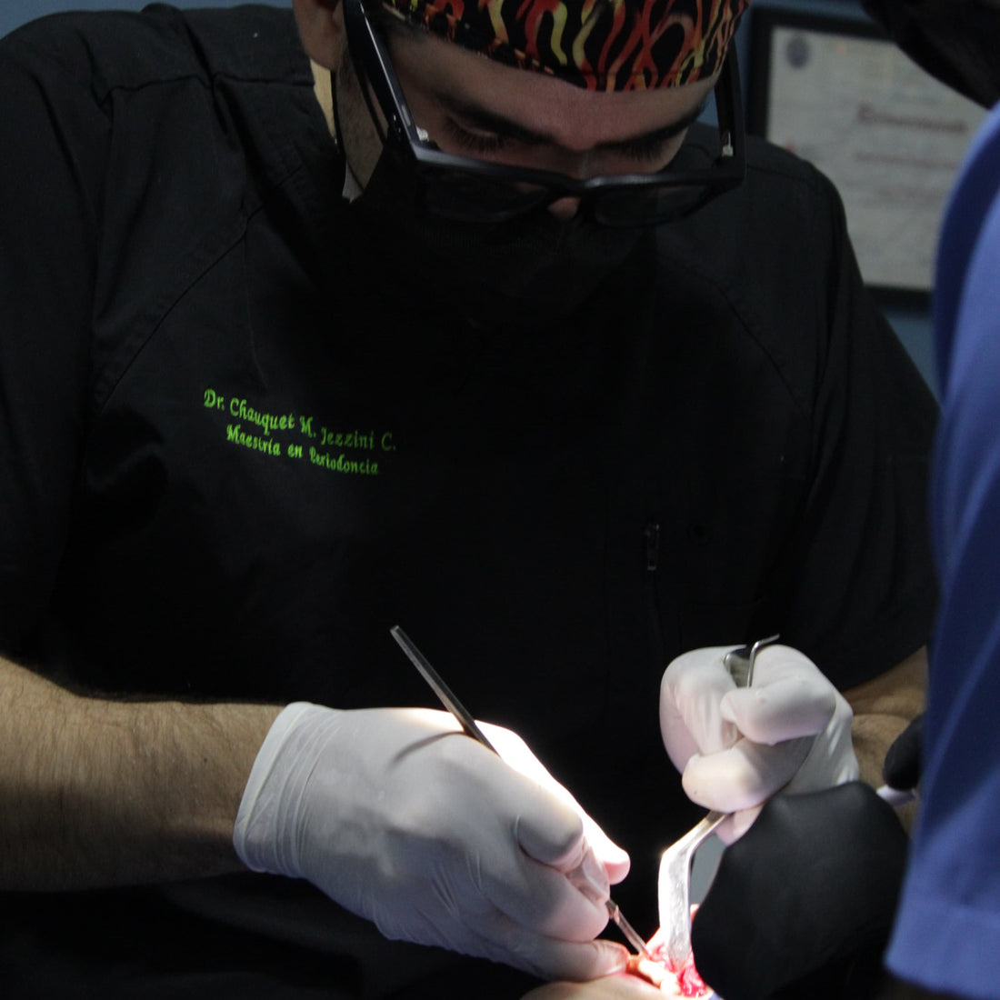 Cuidados post-operatorios en cirugía de implantes